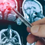 Many do this every day without thinking: the risk of dementia increases by a third