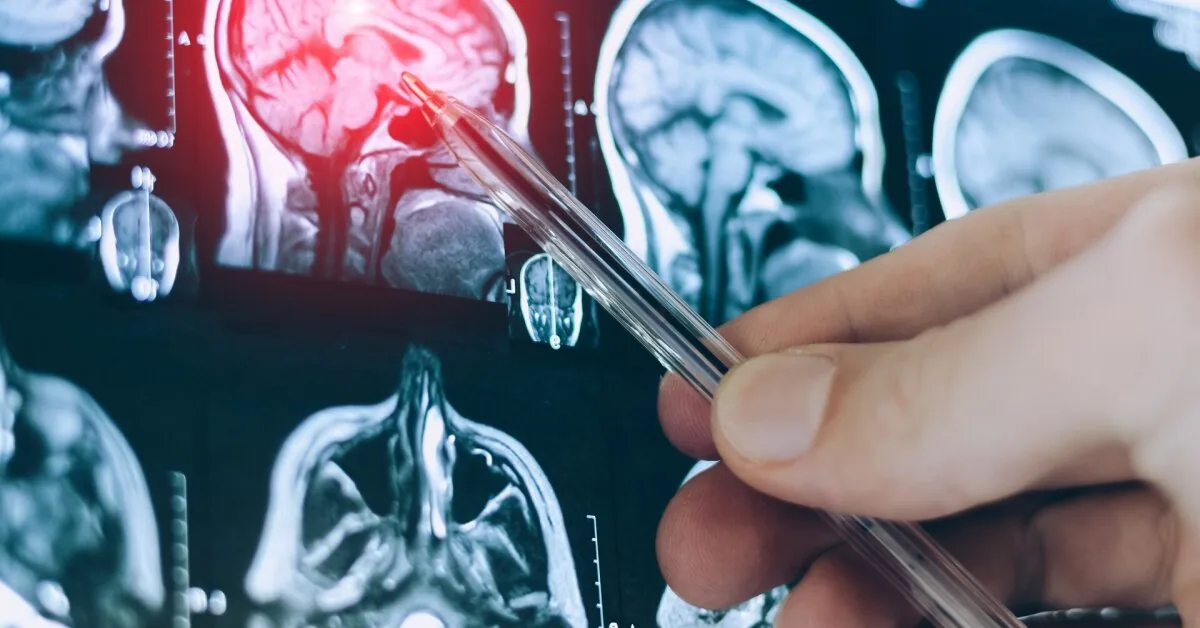 Scientists sound the alarm: this popular habit in middle age can affect your brain