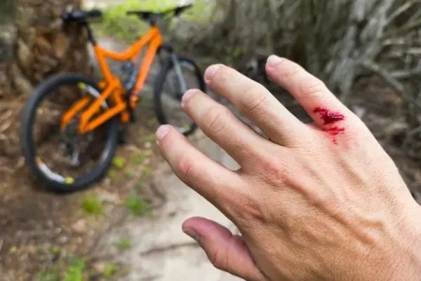Do you think that a blood clot only threatens from rusty metal? A medic warns when else you should be concerned