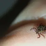 In the first half of the year, fewer cases of tick-borne encephalitis and Lyme disease were recorded in the country