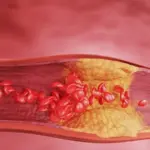 The study revealed a danger: this popular diet can actually increase cholesterol