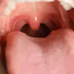 Doctors warn: what lives in your mouth can affect the health of your entire body