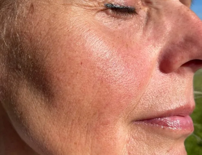 Shutterstock image/Tanned but wrinkled facial skin