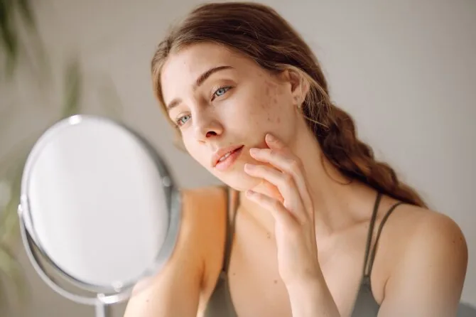 Shutterstock photo/Facial skin