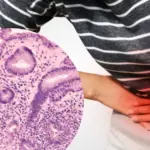 7 warning signs of H. pylori: check without delay