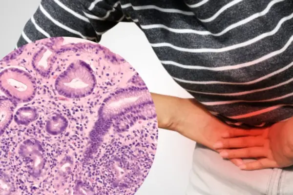 7 warning signs of H. pylori: check without delay