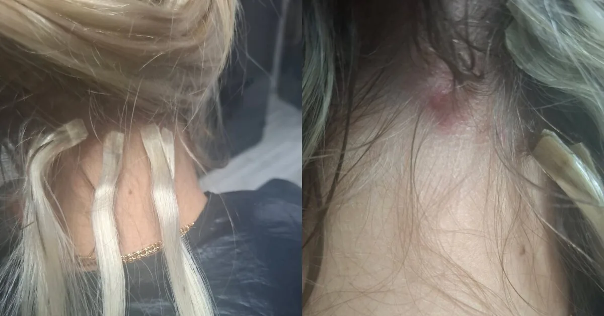 After hair extensions, the woman could no longer even sleep: the master was shocked by what she saw