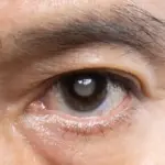This is experienced by everyone: what does a twitching eyelid really hide?