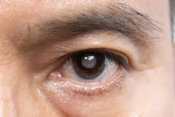 This is experienced by everyone: what does a twitching eyelid really hide?