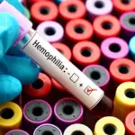 Professional athlete suffered for years from an unnoticed disease: warns about insidious symptoms