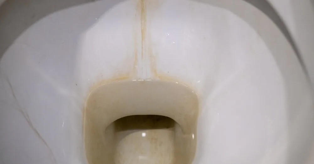 3 tablespoons at night – and in the morning the toilet will shine: old lime deposits will disappear by themselves
